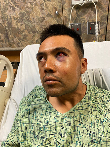 José Antonio Vera Álvarez was hospitalized with injuries to his face and body after he was buried in a trench collapse in Othello, Wash.